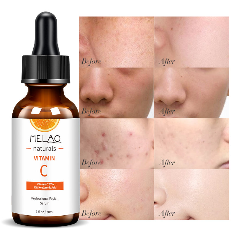 MELAO - Vitamin C 20% Super Brightening Pro Serum