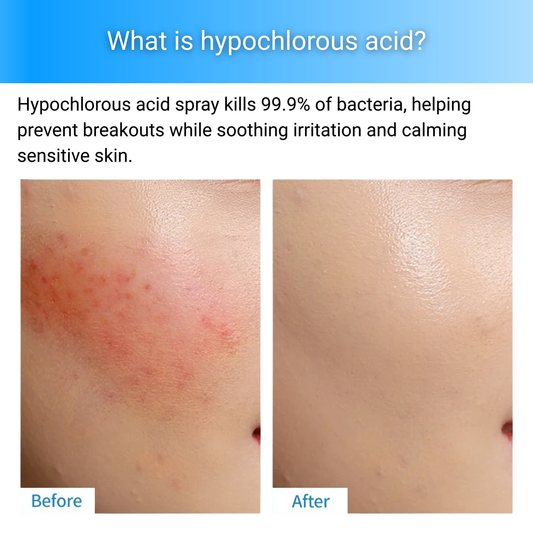 LAKERAIN - Hypochlorous Acid Facial Mist