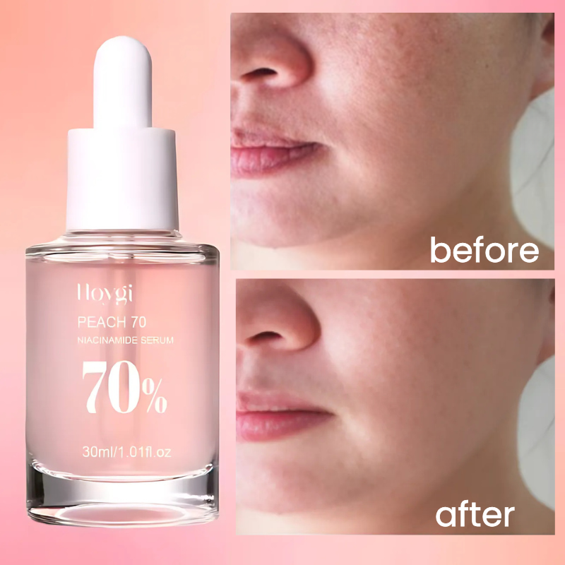 HOYGI - 70% Niacinamide Brightening Serum