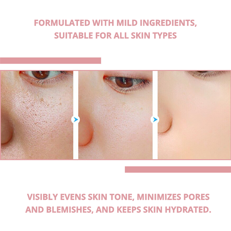 HOYGI - 70% Niacinamide Brightening Serum