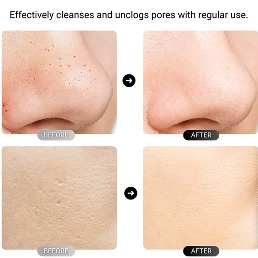 Ultrasonic Skin Scrubber